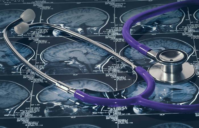 Brain scan of head and skull