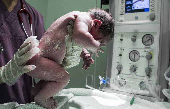 baby being born via caesarean